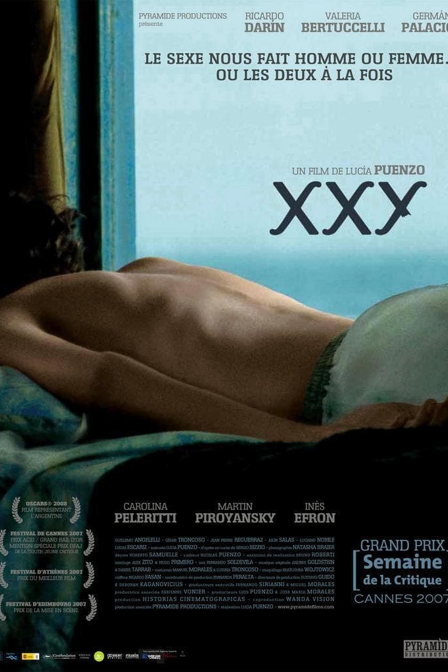 xxy