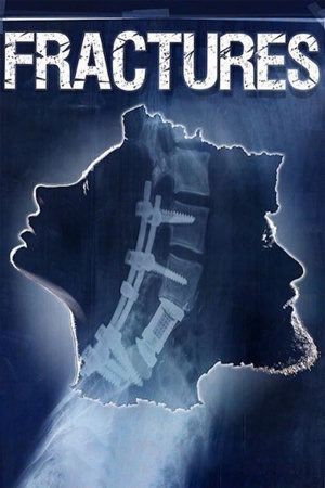 fractures